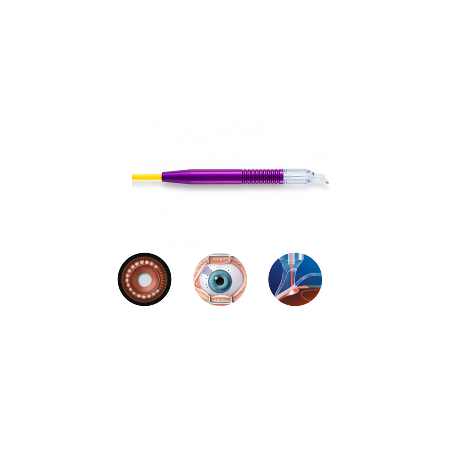 G-Probe® Device